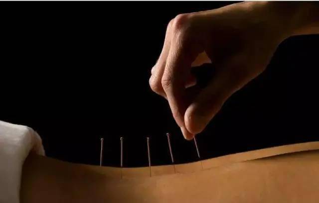 平衡針灸最新視頻，現代應用探索針灸藝術(shù)的新境界