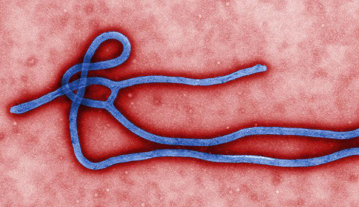 警惕最新病毒病人，你需要了解這些關(guān)鍵信息！