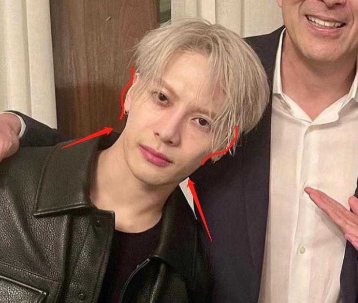 深度解析明星整容后遺癥，觀(guān)點(diǎn)與影響探討