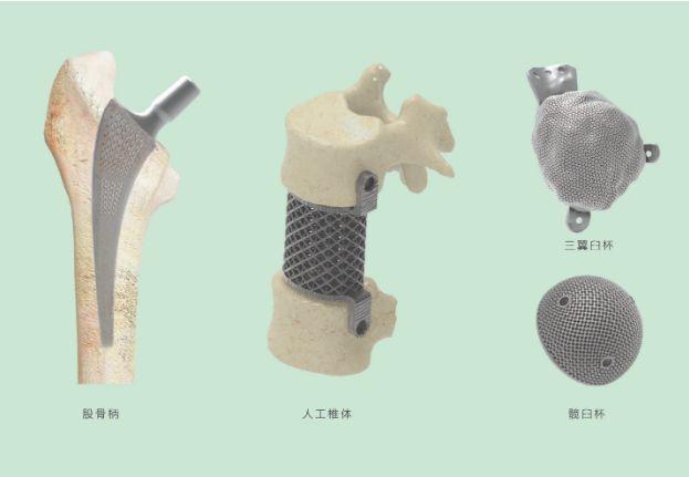 三維打印髖關(guān)節技術(shù)新動(dòng)態(tài)，重塑生活的科技魔法奇跡