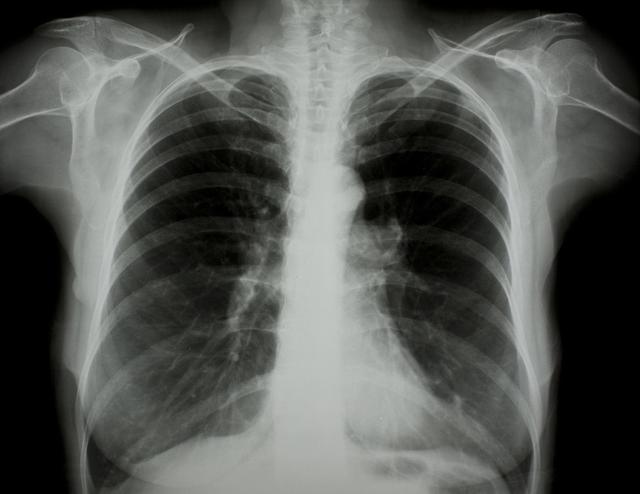 撫順?lè )窝鬃钚聞?dòng)態(tài)與全面步驟指南