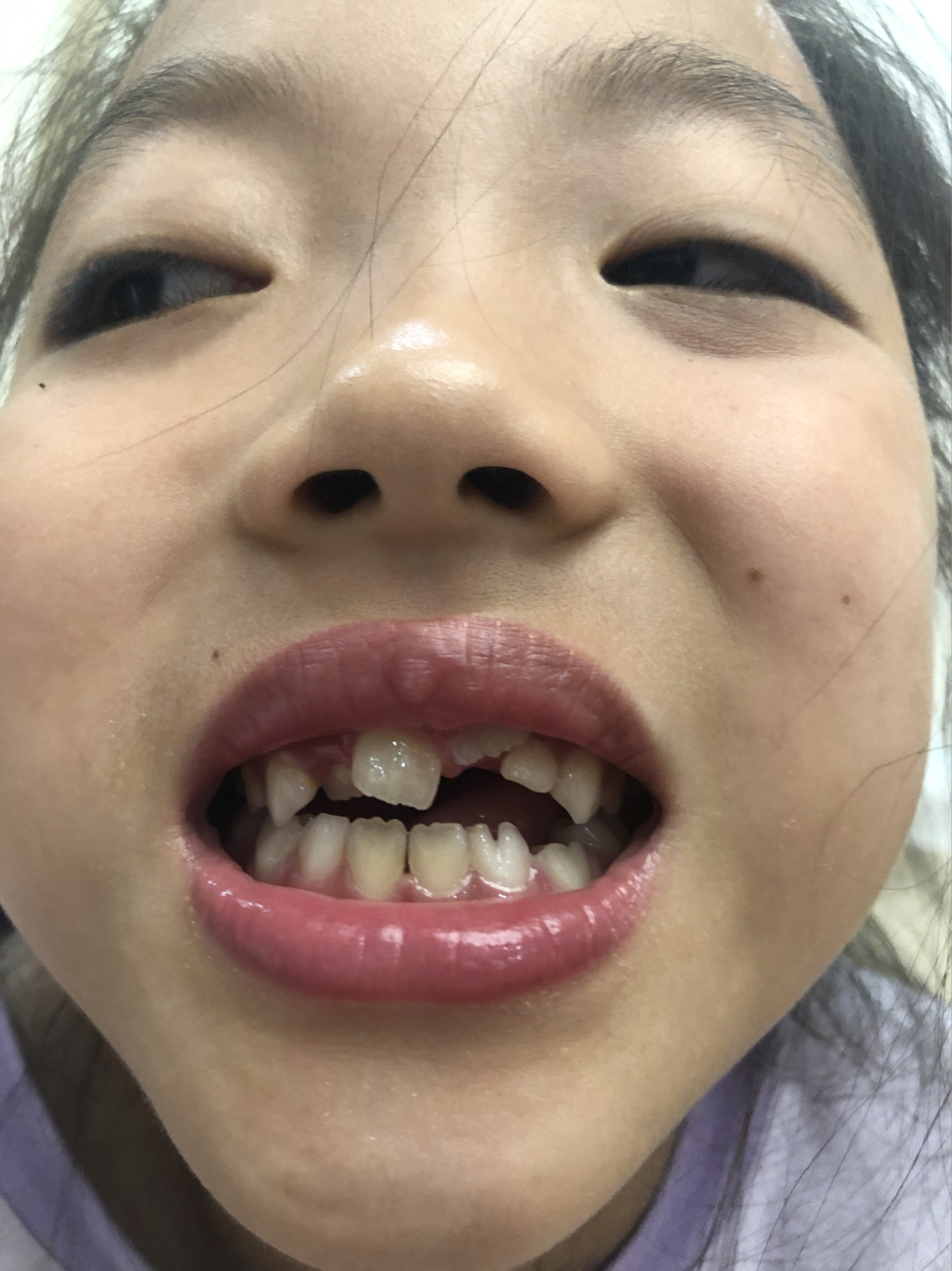 莊最新牙齒技術(shù)揭秘，牙齒美容新選擇